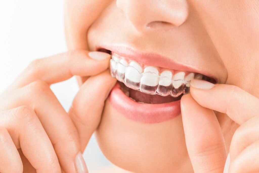 daily invisalign oral health tips from Creekside Dental