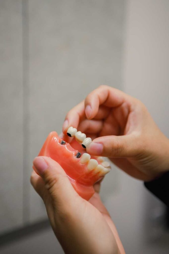 dental crown repair Creekside Dental