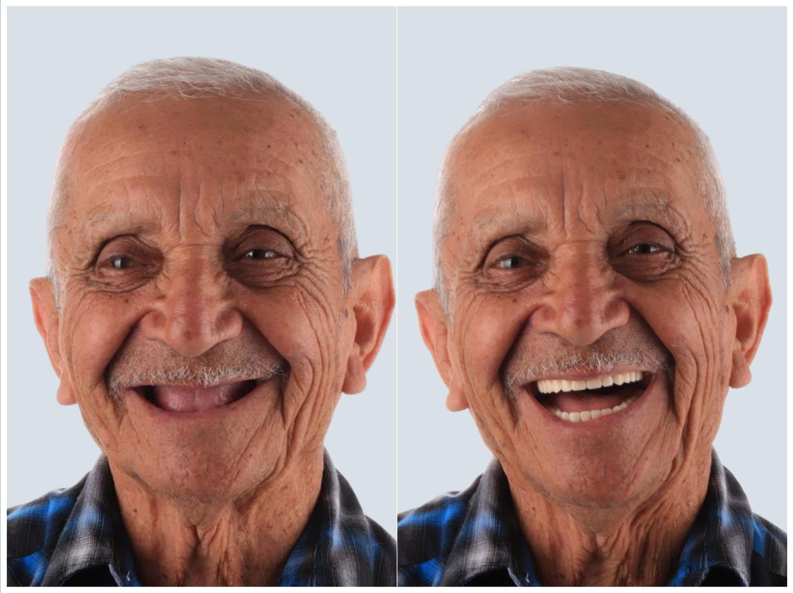 before and after of patient