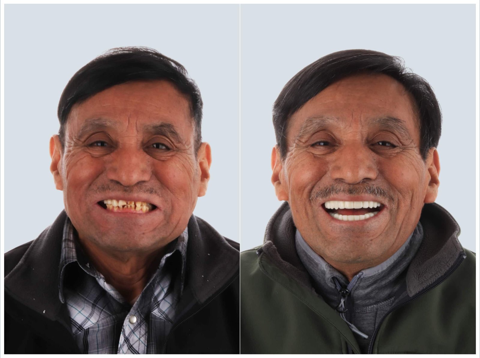 before and after image