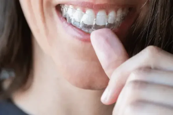 transparent braces